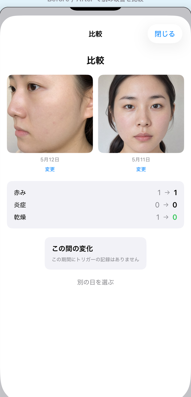 肌ログ 写真比較画面 - Before/Afterで変化を実感